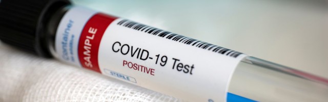 COVID-19: за последние сутки в Эстонии прибавилось 5 новых подтвержденных диагнозов