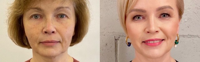 «До и после. Новая жизнь»: смотрите, как изменилась героиня телепроекта! (видео)