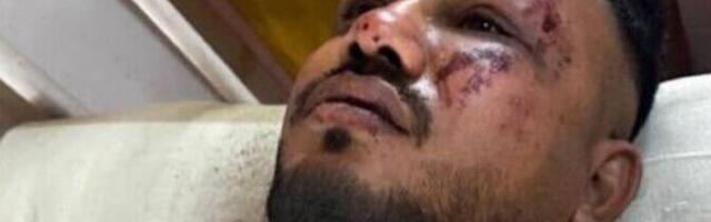 Единственный выживший в авиакатастрофе Air India – 40-летний гражданин Великобритании