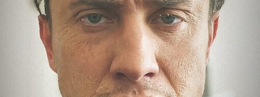 Прилучный шокировал фанатов постаревшим и изможденным видом