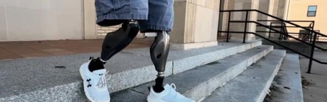 Современные протезы конечностей помогают украинским солдатам быстрее вернуться на фронт