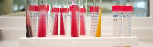 В двух детсадах Риги выявили 106 случаев сальмонеллеза