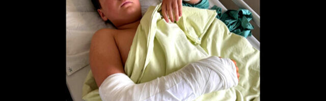 Самокатный конфликт: мужчина получил 60 часов общественных работ за сломанную подростку руку