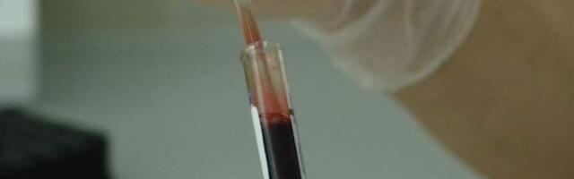 В Индии отмечена вспышка смертельно опасного вируса. Вакцины и лечения от него нет