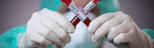 За сутки добавился один позитивный тест на коронавирус