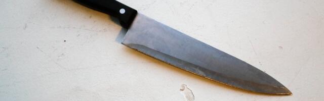 Возле автозаправки 18-летнего молодого человека ударили ножом в лицо 