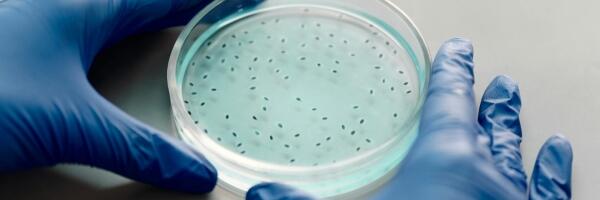 Из-за инфекции E.coli частично приостановлена линия продуктов ручной фасовки Straupe