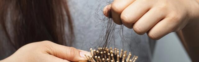 Волосы выпадают пучками? Врач объяснила, какие анализы помогут найти причину