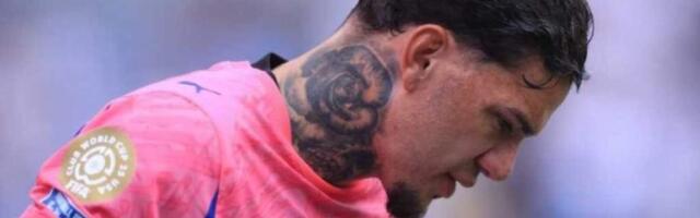 Какие татуировки чаще всего сводят и почему