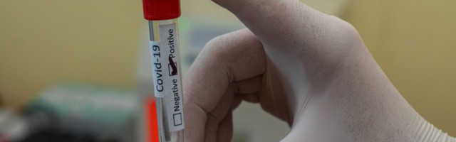 В России зафиксирован антирекорд по числу смертей от коронавируса