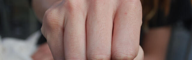 Избивший 76-летнего пенсионера на остановке в Нарва-Йыэсуу получил условный срок