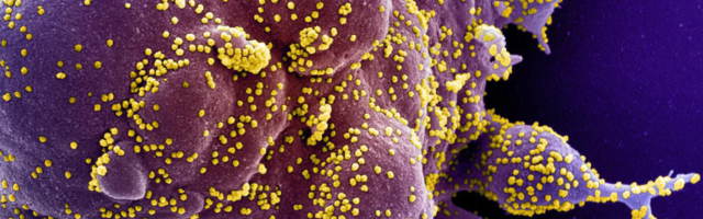 Новое исследование о COVID-19: иммунитет к коронавирусам cохраняется всего шесть месяцев