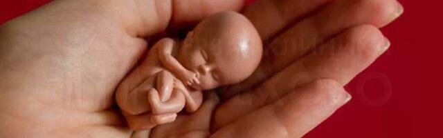 6 из 10 литовцев поддерживают полное или частичное финансирование абортов государством