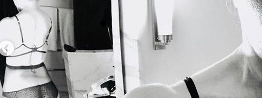 Мадонну высмеяли за неудачную пластическую операцию