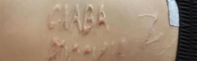 Врач о российских хирургах-садистах: я бы выпустил в них всю обойму, и совесть меня бы не мучила