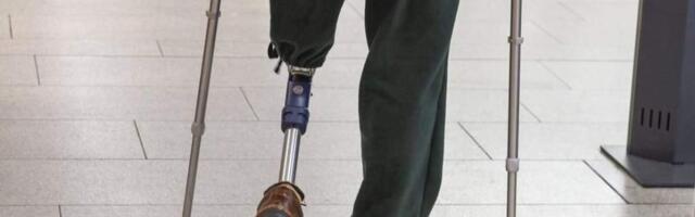 Немецкие компании резко нарастили поставки протезов в Россию