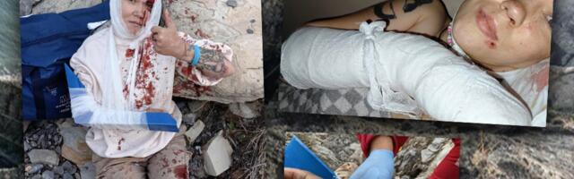 Гражданка Эстонии выжила после падения со скалы в России: „Самое страшное — это четыре секунды свободного падения и удары головой“