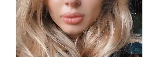 «Уменьшила нос на карантине»: слухи вынудили Лободу рассказать правду