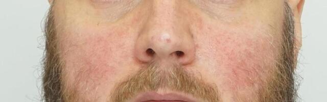 Полиция разыскивает пропавшего 41-летнего мужчину. Он может находиться в Таллинне 