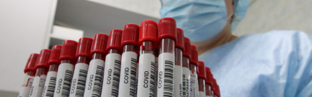 ВОЗ сообщила о рекордном приросте заболевших COVID-19 за сутки. Общее число случаев приблизилось к 9 миллионам