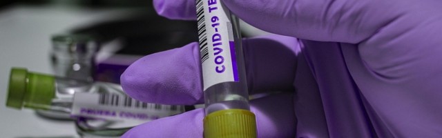 Ежедневный отчёт департамента здоровья на 27 сентября — плюс 35 новых случаев коронавируса