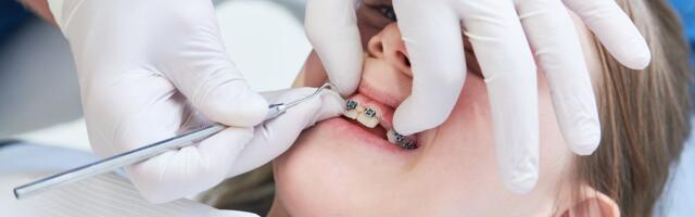 Огромные очереди к ортодонтам заметно сократились. Но не потому, что люди стали более здоровыми