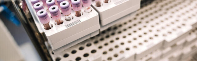 Synlab снизила цены на лабораторные услуги из-за сокращения тарифов Кассы здоровья