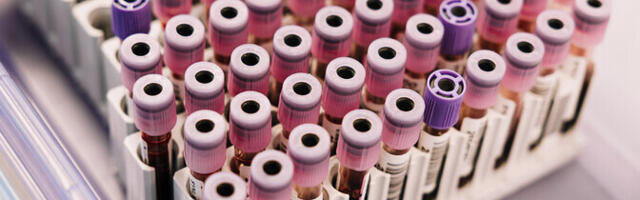 Сокращение предельных цен на лабораторные услуги вызывает обеспокоенность у больниц