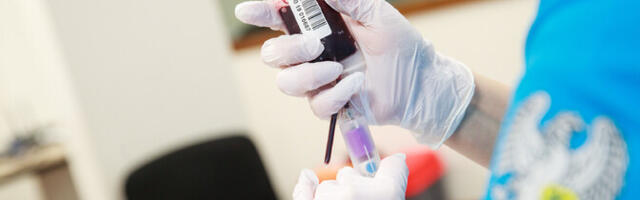 В PERH нуждаются в помощи доноров