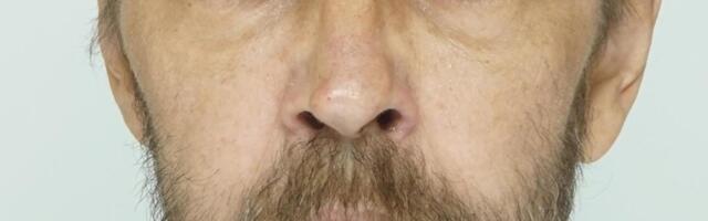 Полиция ищет пропавшего мужчину, который испытывает проблемы со здоровьем