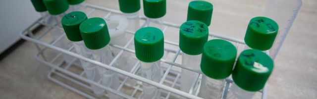 Ученые предупредили о многолетних последствиях коронавируса для организма