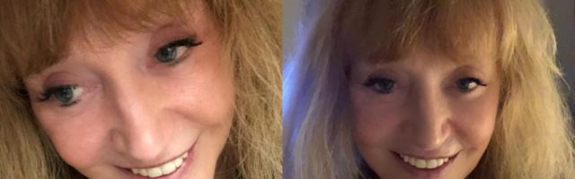 Омолодившаяся Пугачева похвасталась идеальными зубами и свежей кожей