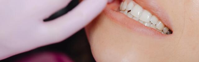 Можно ли в Эстонии застраховать зубы — и когда это вообще работает?