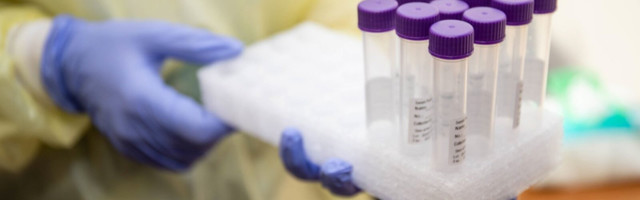 "Полнейшая чепуха". Сдавать тесты на антитела к ковиду нет смысла?