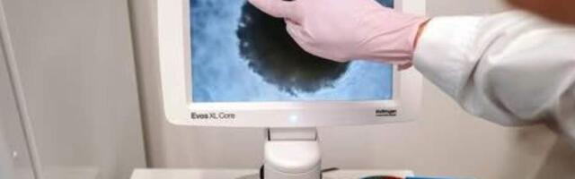 Рак кишечника молодеет: врачи требуют ранней диагностики