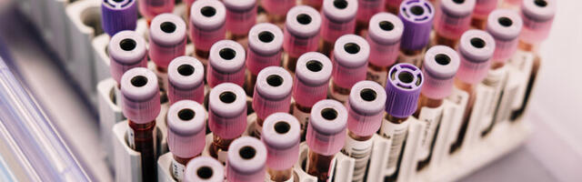 Касса здоровья: нет оснований определять уровень витамина D при рутинном анализе крови