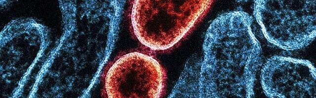 Департамент здоровья: вероятность попадания вируса Nipah в Эстонию крайне низка