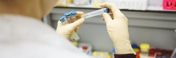 За сутки зафиксировано 36 новых случаев коронавируса