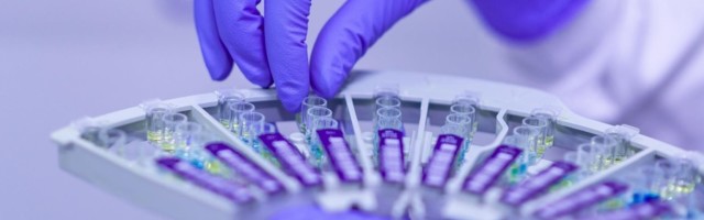 Covid-19 выявлен у 57 жителей Эстонии