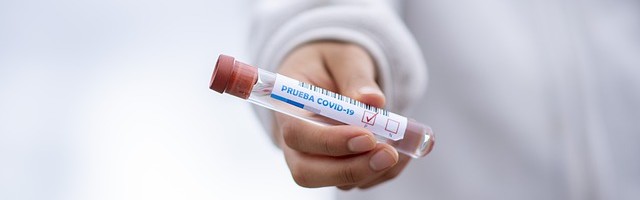 Ежедневный отчёт департамента здоровья на 25 сентября — плюс 42 новых случаев коронавируса