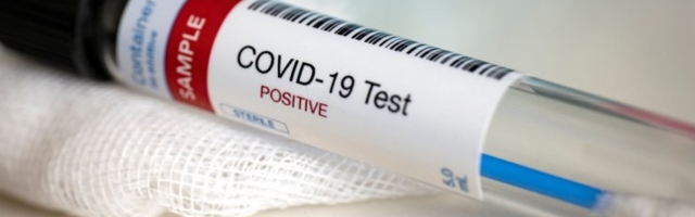 ГРАФИК | Опасная тенденция: число положительных тестов на коронавирус выросло до самого высокого уровня последних пяти недель