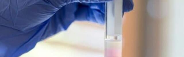 У швейцарцев из сельской местности выявлено более низкое качество спермы