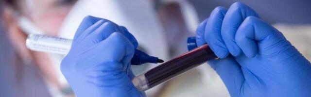 В Германии диагностировано рекордное число заражений сифилисом