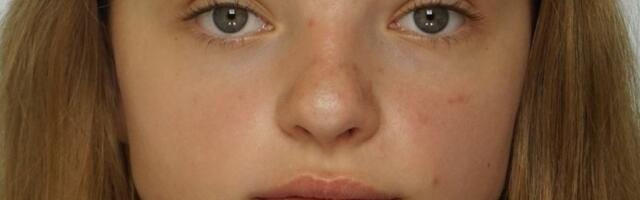 Полиция ищет пропавшую в Ида-Вирума 17-летнюю девушку