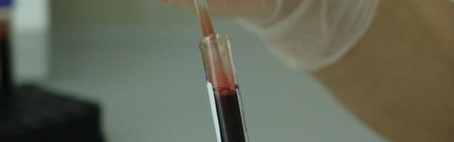 В Индии отмечена вспышка смертельно опасного вируса. Вакцины и лечения от него нет