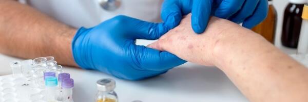 В связи с продолжающейся вспышкой кори зарегистрировано уже 24 заболевших