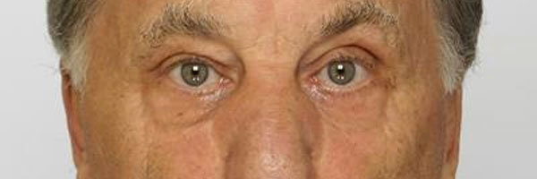 Полиция просит помощи в поисках пропавшего в волости Тапа Андрея. Мужчина может попасть в беду