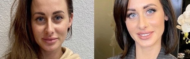 «До и после. Новая жизнь»: смотрите, как преобразилась Алина!