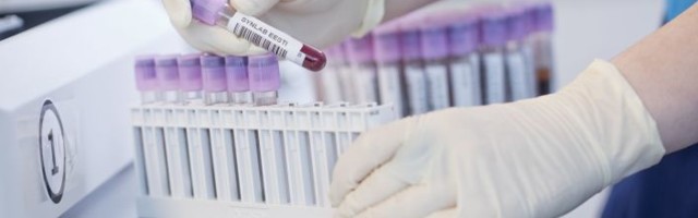 В Эстонии снизили стоимость ПЦР-теста на коронавирус