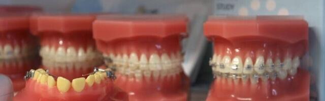 Цены на ортодонтическое лечение растут, решений не видно